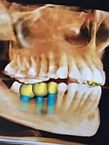 whatsapp image 2026 02 22 at 22.46.23 (3)